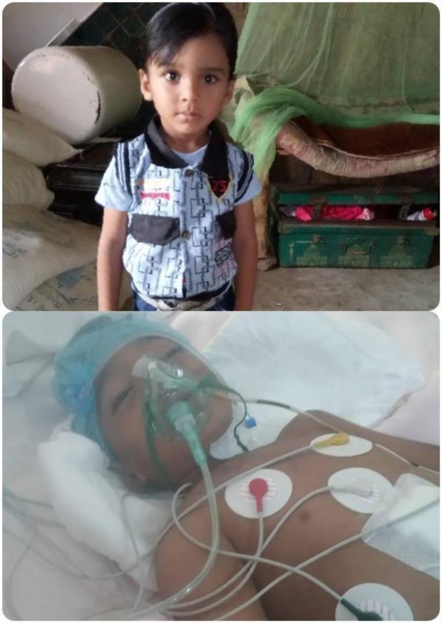 #صعدة : استشهاد طفل متأثرا بجراح أصيب بها في قصف سعودي بصعدة
